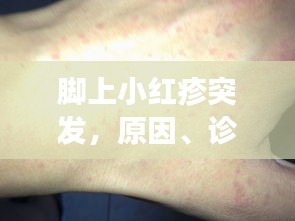 将陋就简